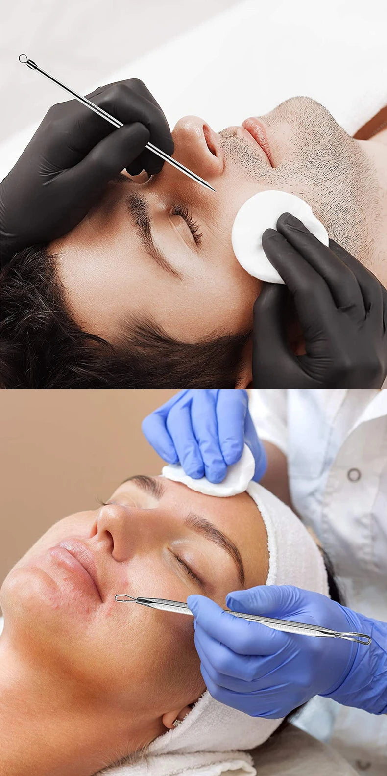 Acne Blackhead Removal  Stainless Steel Skin Care Kit