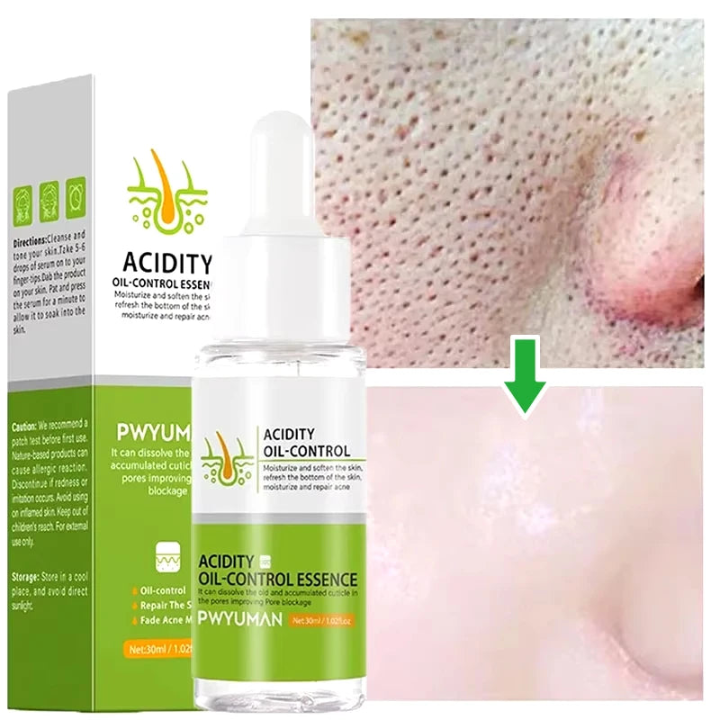 Pore-Fect Glow: Salicylic Acid Cream for Clear, Tight, Radiant Skin!