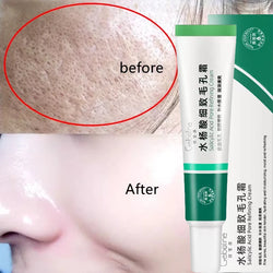 Pore-Fect Glow: Salicylic Acid Cream for Clear, Tight, Radiant Skin!