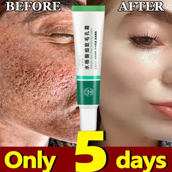 Pore-Fect Glow: Salicylic Acid Cream for Clear, Tight, Radiant Skin!