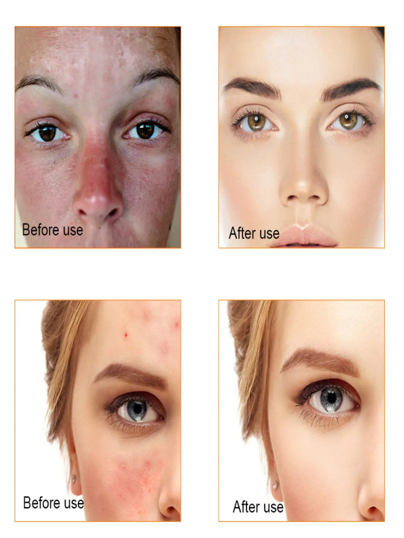 Radiant Glow: Your Guide to Flawless Skin