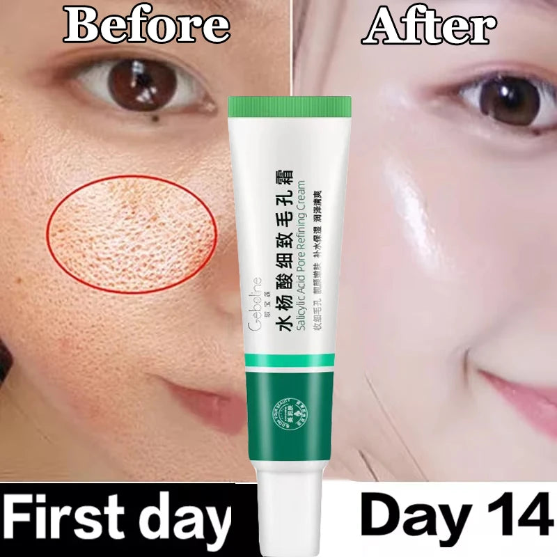 Pore-Fect Glow: Salicylic Acid Cream for Clear, Tight, Radiant Skin!
