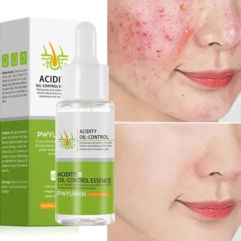Pore-Fect Glow: Salicylic Acid Cream for Clear, Tight, Radiant Skin!