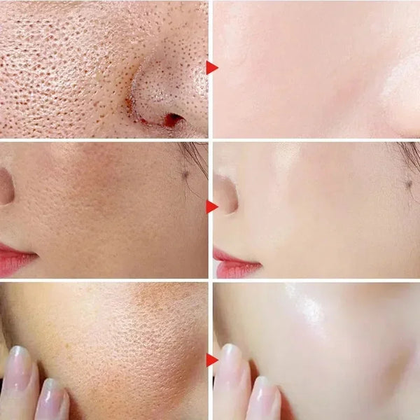 Pore-Fect Glow: Salicylic Acid Cream for Clear, Tight, Radiant Skin!