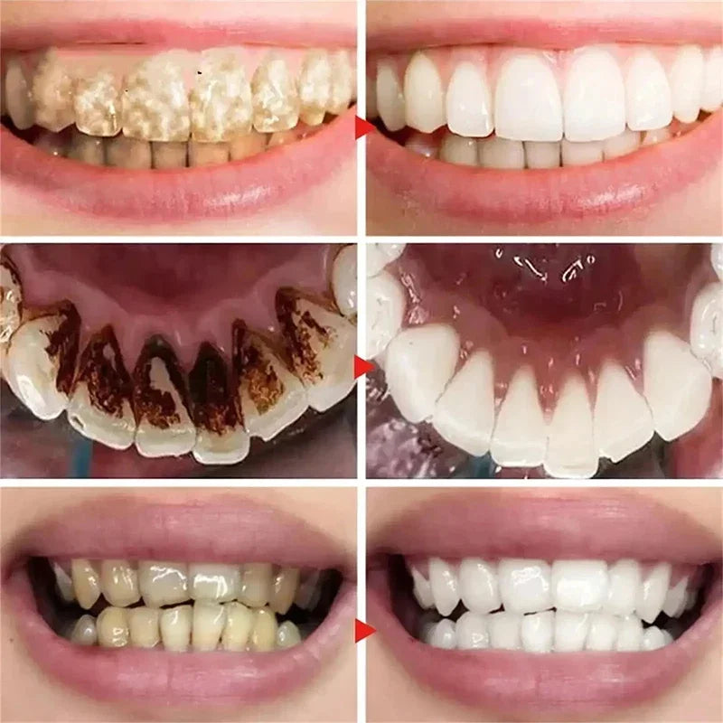 Brighten Your Smile 5D Teeth Whitening Toothpaste
