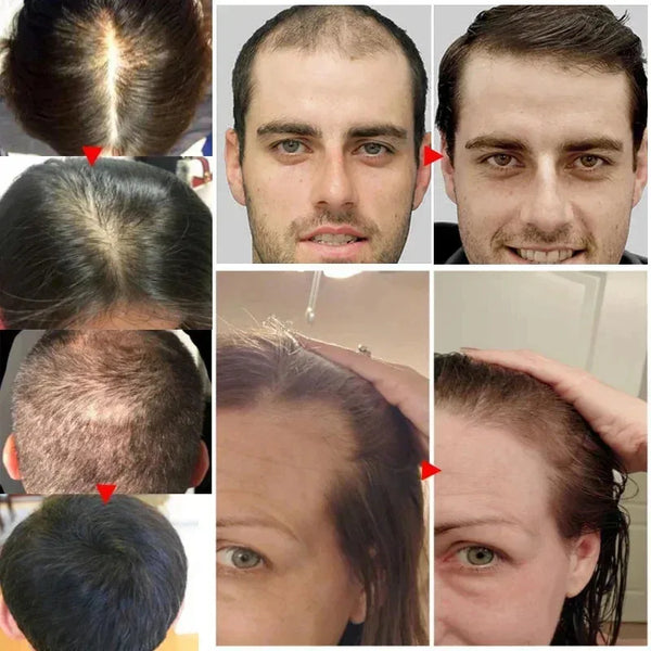 Biotin Hair Growth Serum