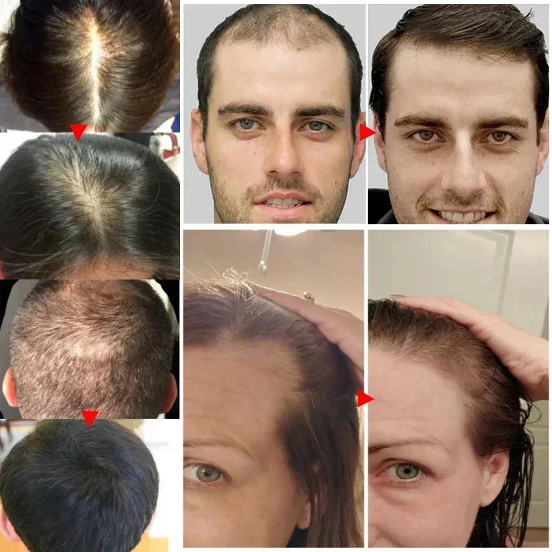 Biotin Hair Growth Serum